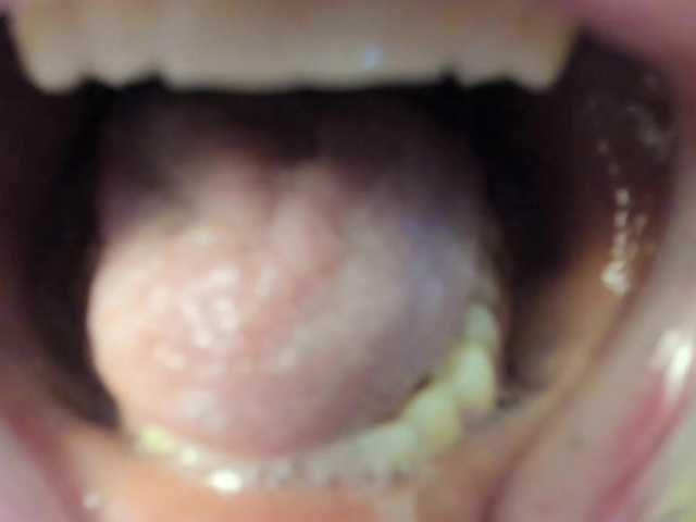 Емитовање снимка екрана spellmananto